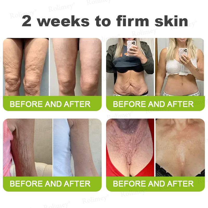 👨‍⚕️Made and shipped from Australia 💫Rolimey® Botox & Vita-A Retinol Shot Wrinkle-Lift Tightening cream - Last Day Promotion 70% OFF