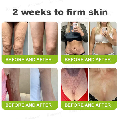 👨‍⚕️Made and shipped from Australia 💫Rolimey® Botox & Vita-A Retinol Shot Wrinkle-Lift Tightening cream - Last Day Promotion 70% OFF