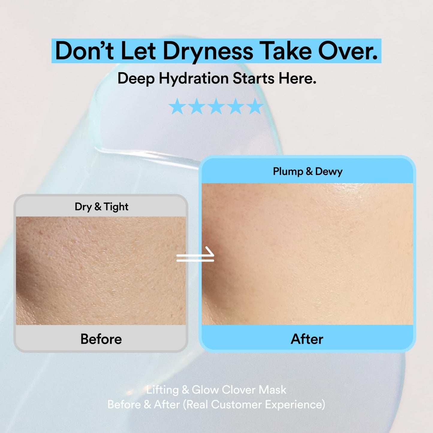 Skit Hydrating & Moisture Face Gel Patch | Hyaluronic Acid Hydrogel Patches with Glyceryl Glucoside for Deep Hydration & Soothing Care, Targeted Clover Mask, Korean Skincare | 4 Sets (8 Patches)