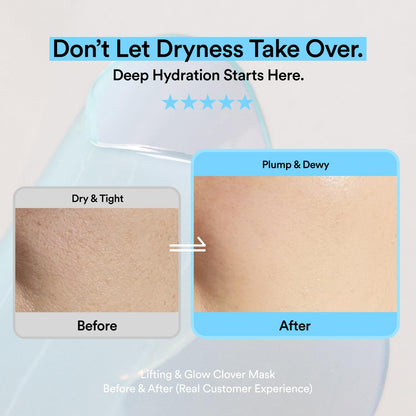 Skit Hydrating & Moisture Face Gel Patch | Hyaluronic Acid Hydrogel Patches with Glyceryl Glucoside for Deep Hydration & Soothing Care, Targeted Clover Mask, Korean Skincare | 4 Sets (8 Patches)