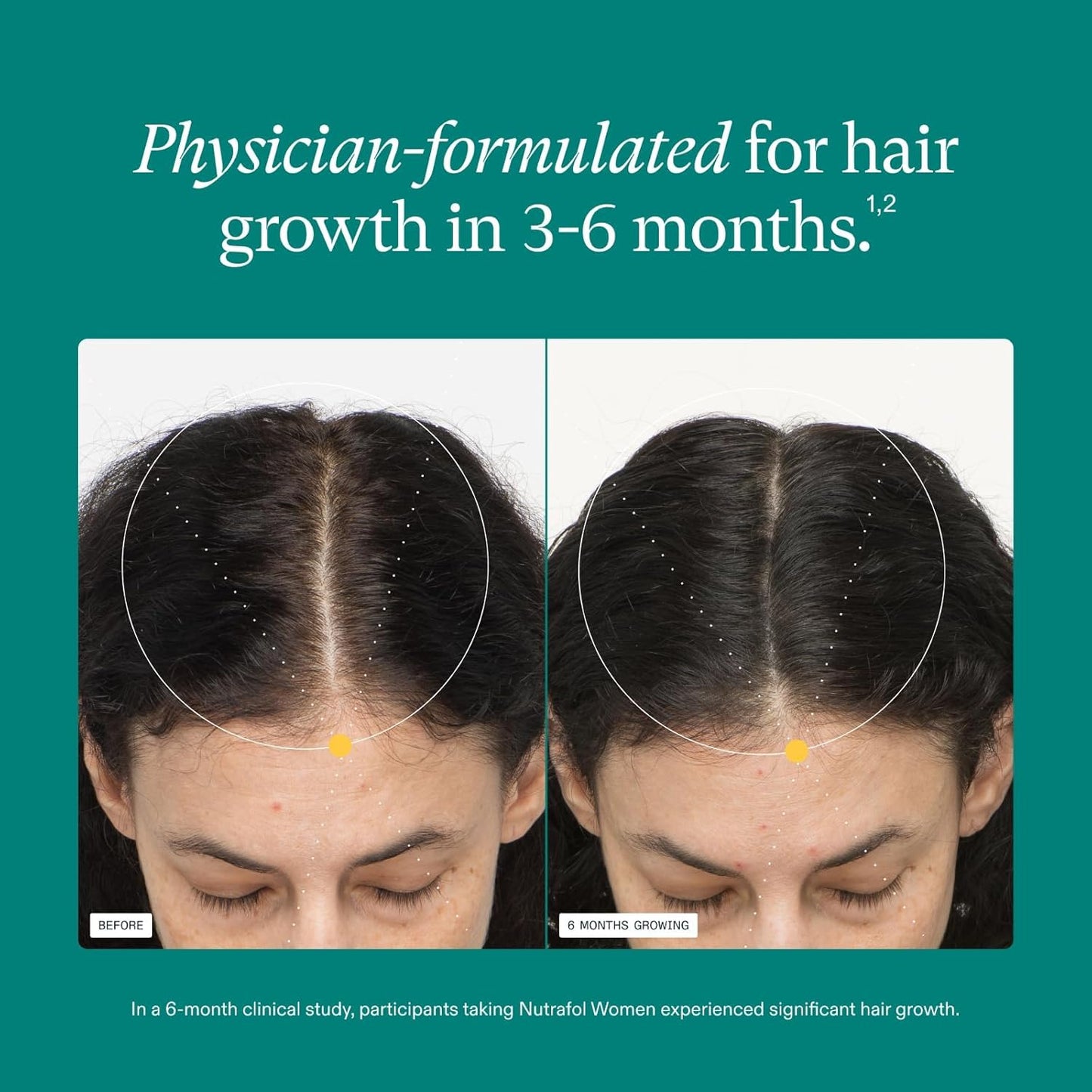 Nutrafol Women's Hair Growth Supplements, Clinically Proven for Visibly Thicker and Stronger Hair