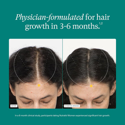 Nutrafol Women's Hair Growth Supplements, Clinically Proven for Visibly Thicker and Stronger Hair