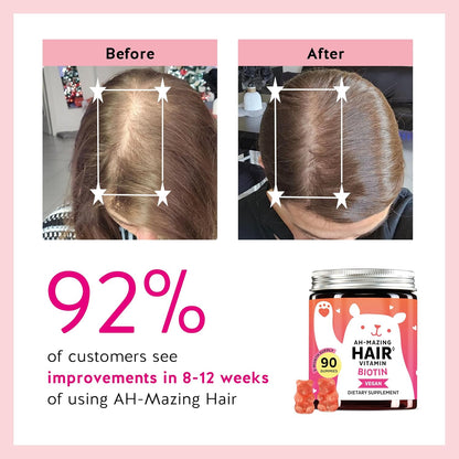 Bears with Benefits Biotin Gummies for Hair Growth, Skin & Nails –  5000 mcg Biotin + Vitamins C & E + Zinc - 30 Gummies - Vegan Wild Berry Flavor - 1 Month Supply