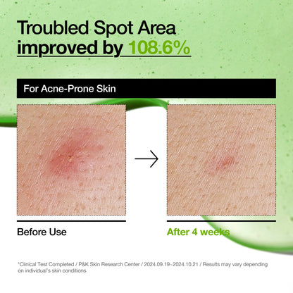 Azelaic Acid 10 Hyaluron Redness Soothing Serum
